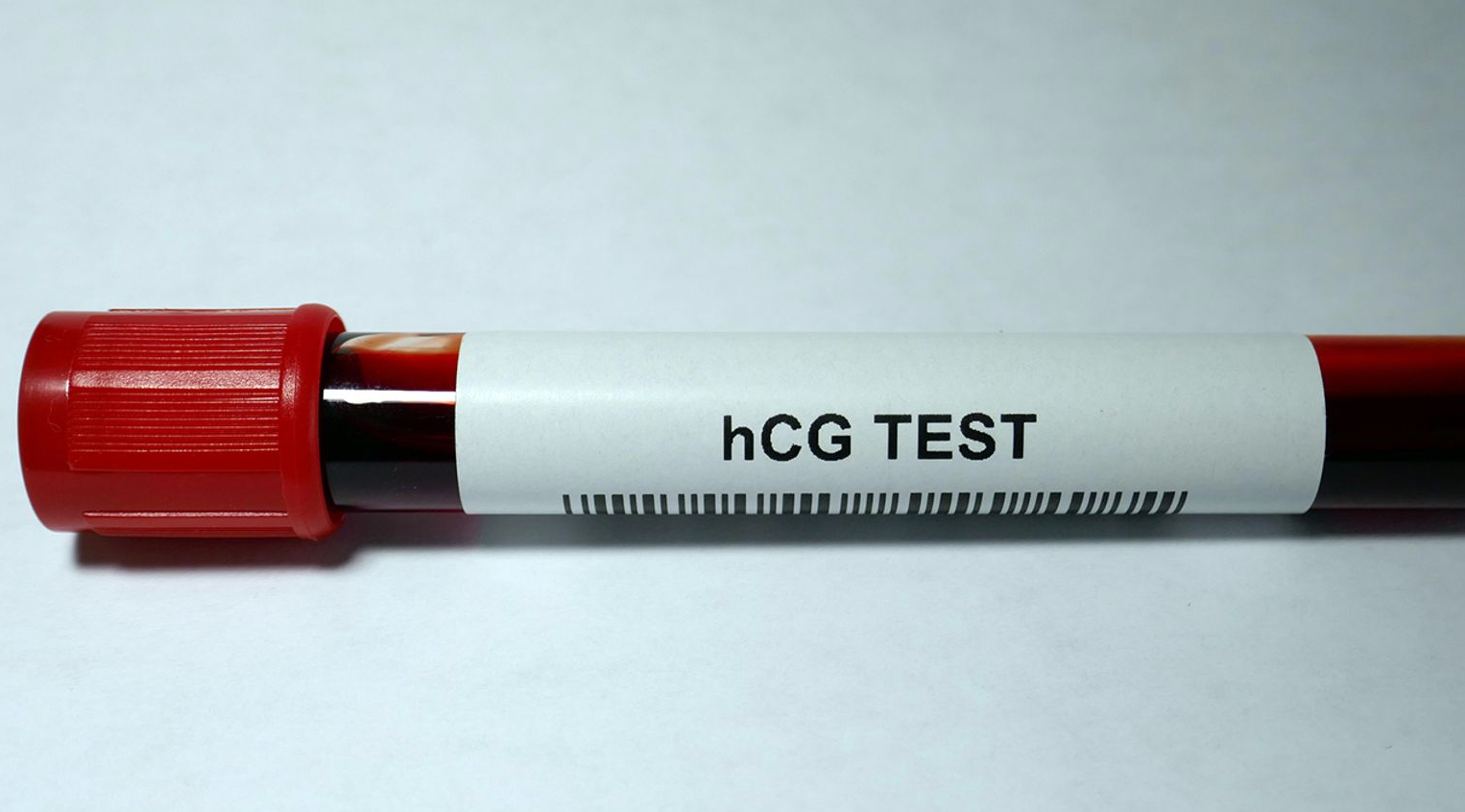 Pruebas de embarazo
